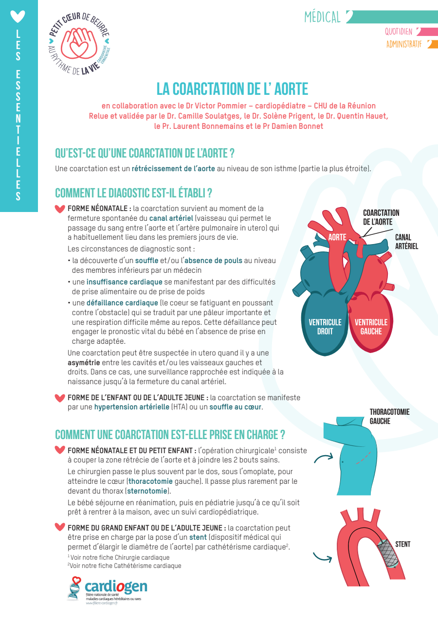 Coarctation de l'aorte